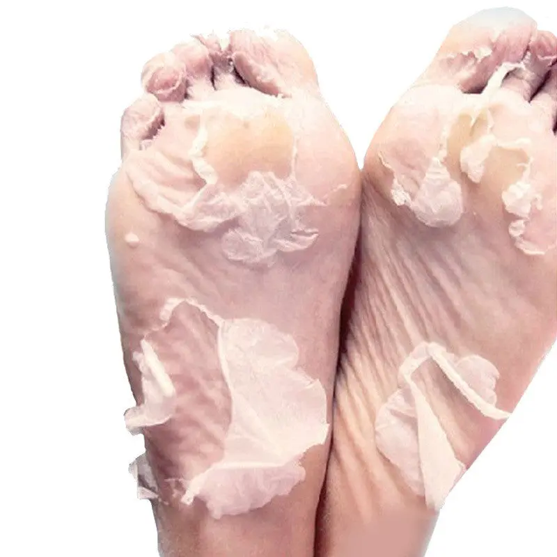 2Pair=4Pcs Foot Mask Peeling Dead Skin Smooth Exfoliating Feet Care Socks Pedicure Socks For Heels Peeling Cuticles Removal 1