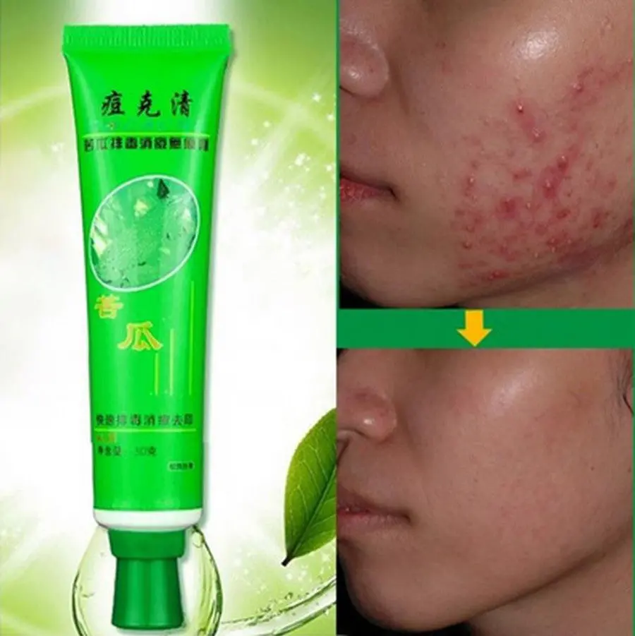 30G Face Skin Care Acne Cream Oil Control Acne Products Face Cream Beauty 1