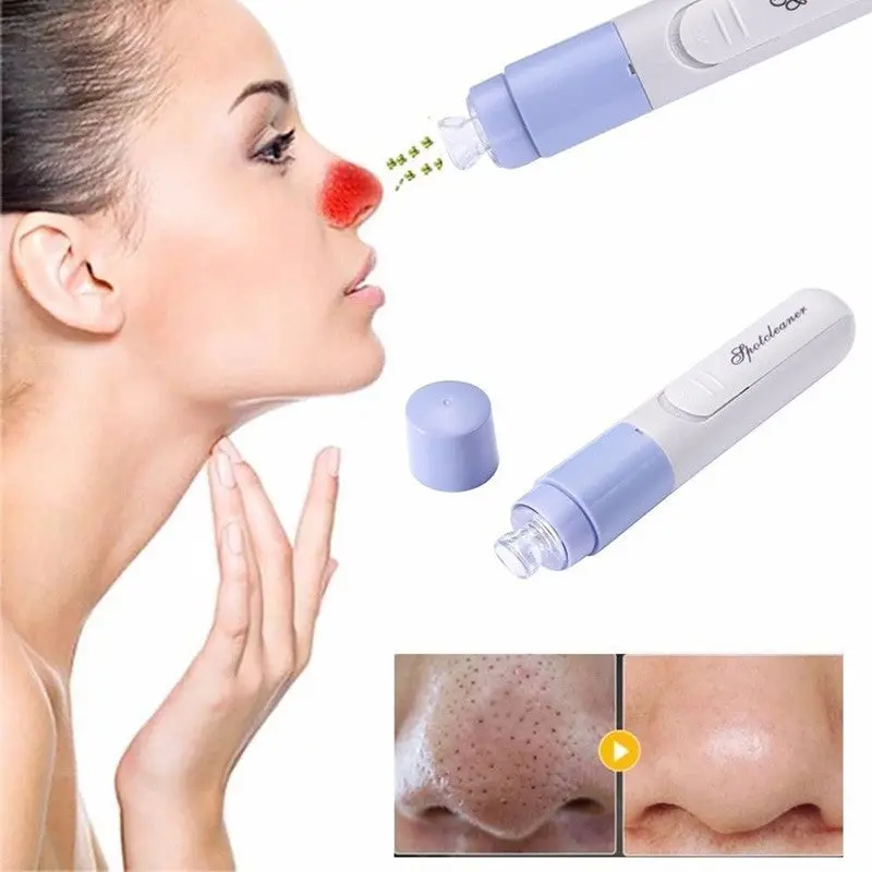 Cleaner Vacuum Suction Facia Blackhead Removal Skin Care Cleansing Tool 1